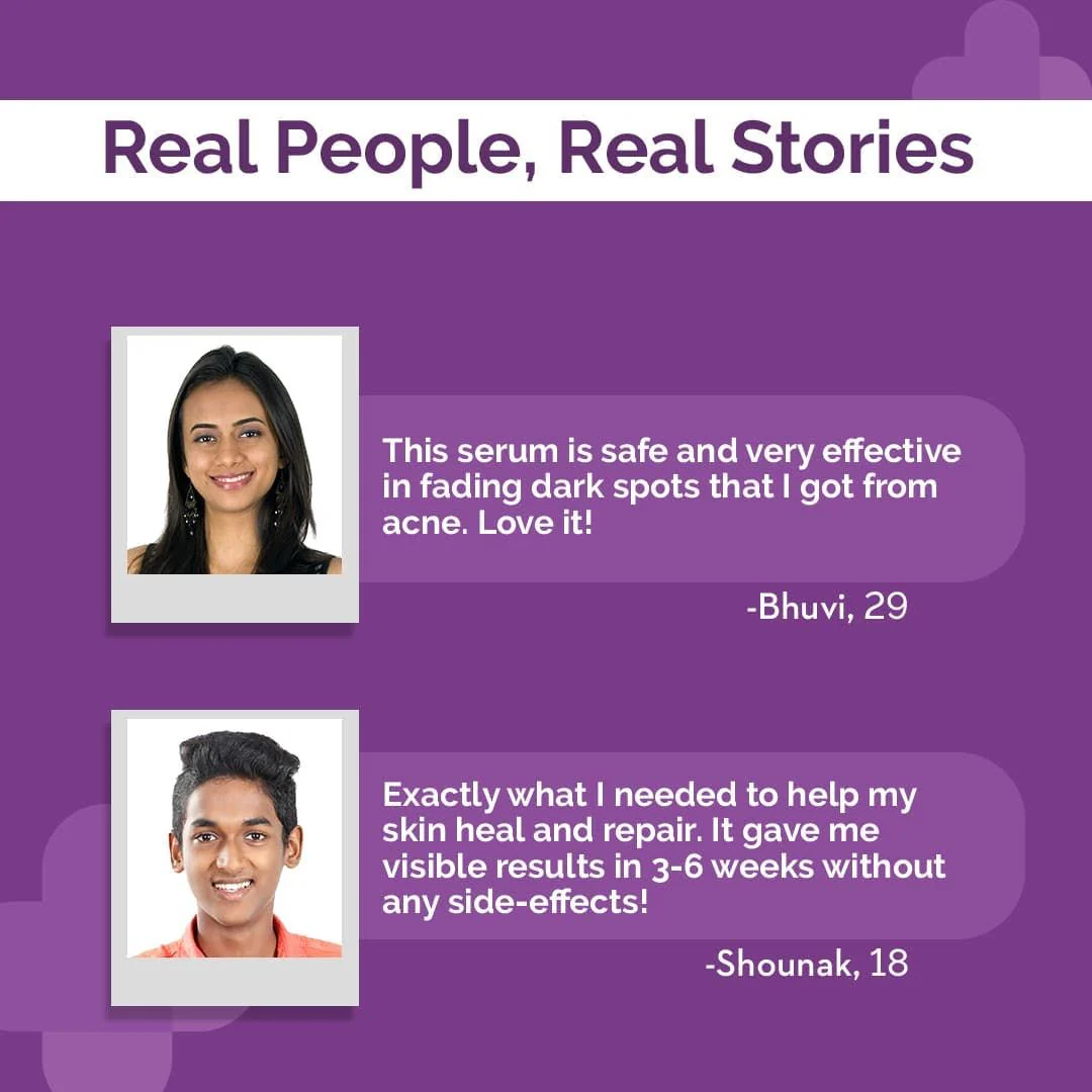 2% Alpha Arbutin Face Serum - 30ml - Image 7