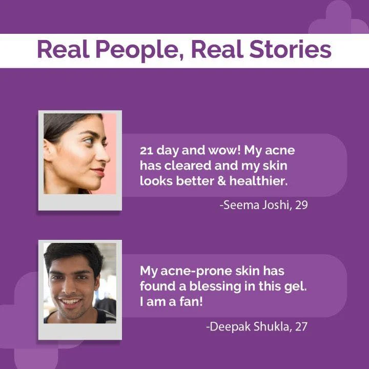 5% AHA BHA Face Gel - 30g - Image 6